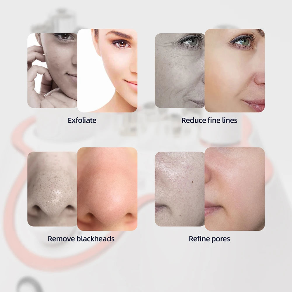 Professional Diamond Microdermabrasion Facial Peeling Machine for Home Skin Care