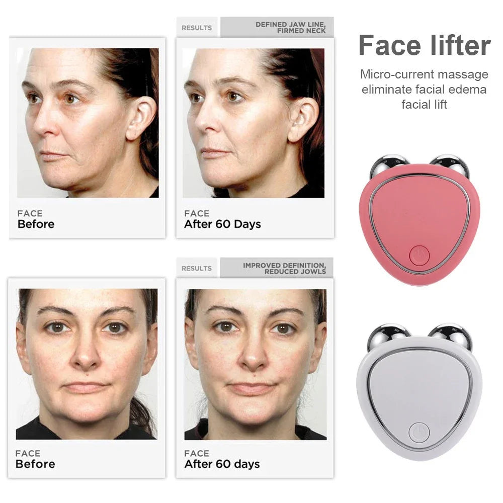 Facial Electric Lifting Roller Massager Microcurrent Skin Tightening Rejuvenation