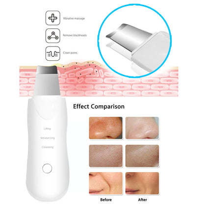 Ultrasonic Skin Scrubber Facial Cleaner Blackhead Peeling Massager Shovel